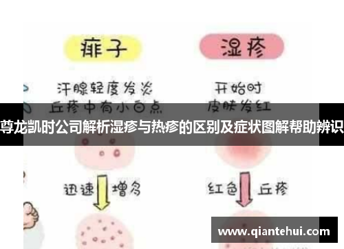 尊龙凯时公司解析湿疹与热疹的区别及症状图解帮助辨识